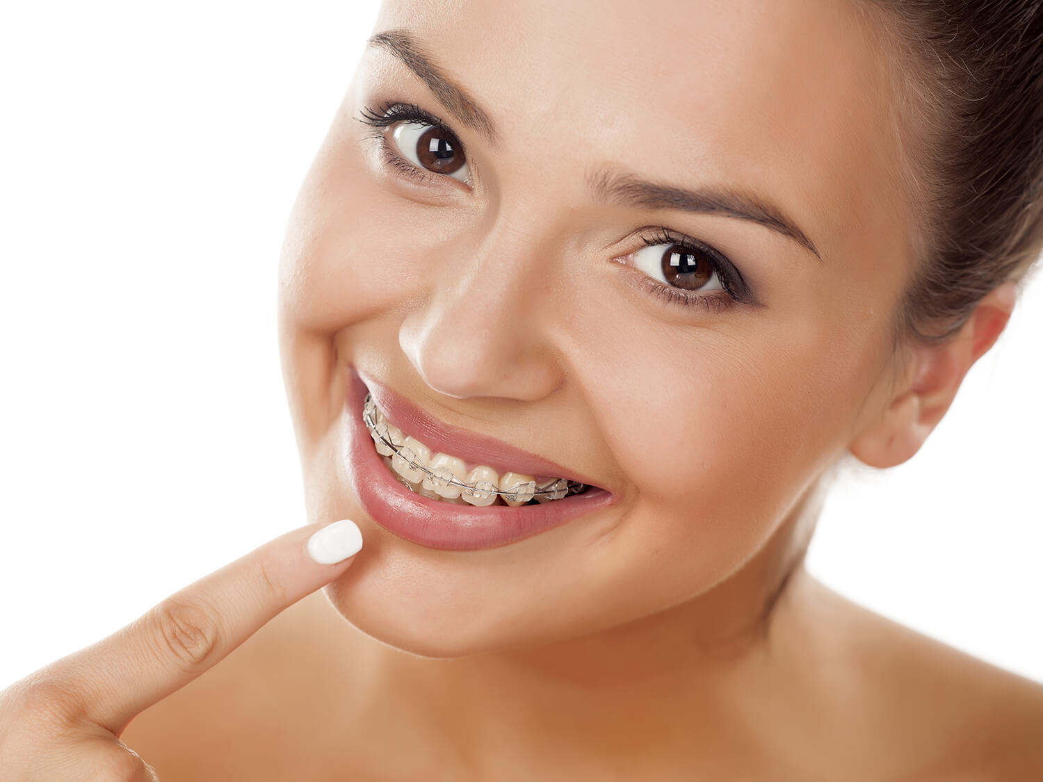 ventajas que aporta la ortodoncia a nuestra vida